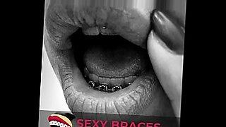 braces-porn